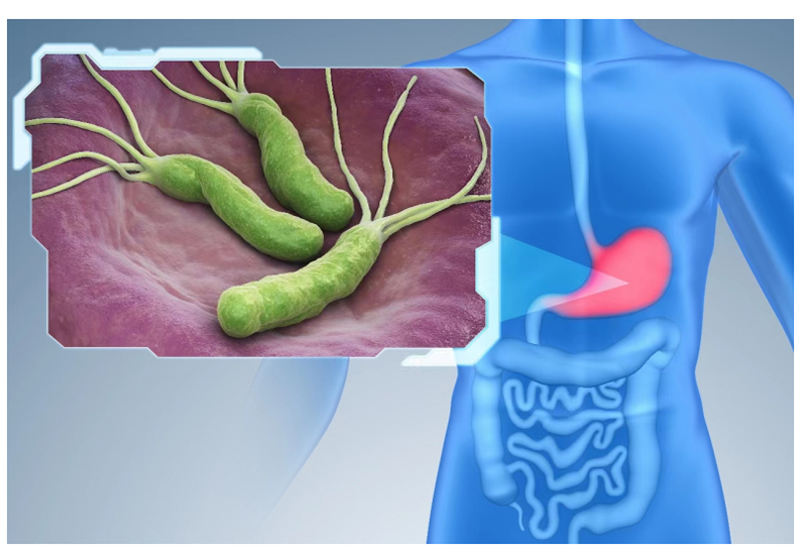 C13&C14 Helicobacter Pylori Urea Breath Test Solution