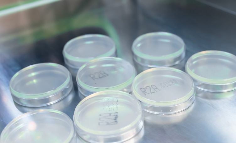blood culture
